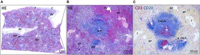 Age-Related Variation in Sympathetic Nerve Distribution in the Human Spleen